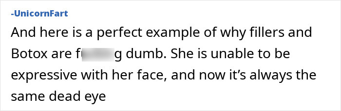 Anne Hathaway looking serious and unexpressive days after fans noticed something off about her Oscars appearance.