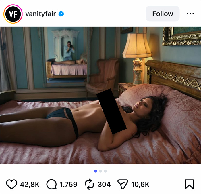 Kylie Jenner posing in lingerie on a bed in a vintage room, highlighting the cultural impact of the BBL.
