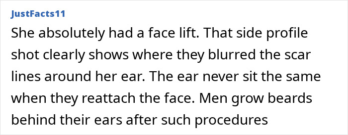 Text screenshot discussing suspected face lift on Anne Hathaway, mentioning blurred scar lines and changes near the ear.