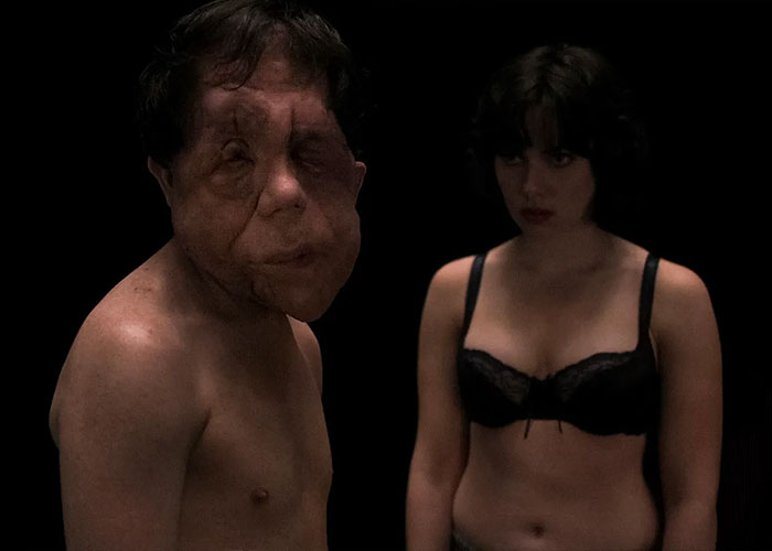 Homem com deformidade facial e mulher de lingerie preta em pé sobre fundo escuro, relacionado à polêmica de Adam Pearson.