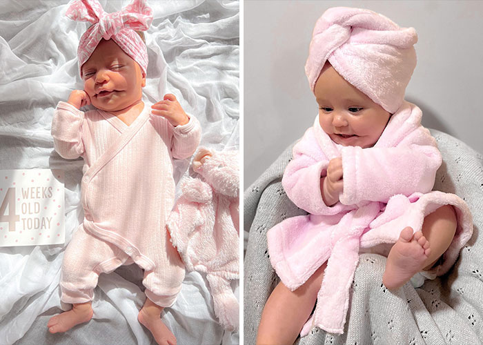 Newborn baby with rare medical condition shown in pink outfit and towel, highlighting bizarre medical problems and mysteries.