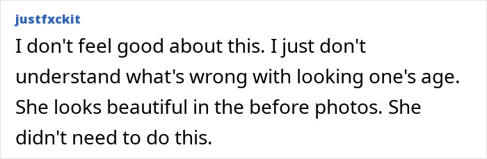 Denise Richards revela transformação dramática do facelift em fotos de antes e depois