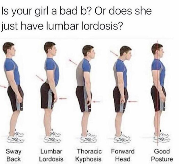 Man demonstrating sway back, lumbar lordosis, thoracic kyphosis, forward head, and good posture in medical meme for doctors or patients.
