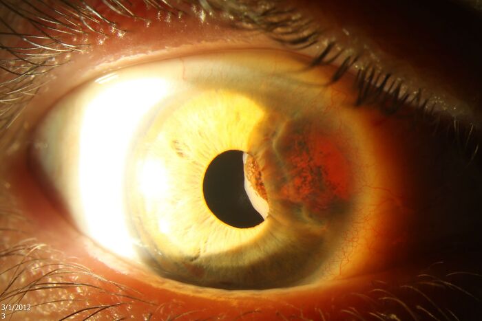 Close-up of a human eye showing unusual features that highlight freaky body design and evolution flaws.