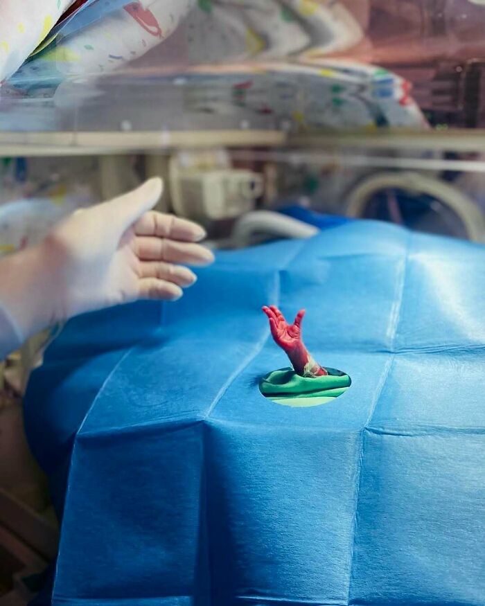 Premature newborn’s tiny red hand reaching through medical drape during an unusual medical procedure in a clinical setting.