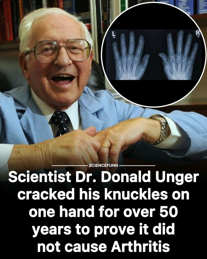 Scientist Dr. Donald Unger’s 50-year knuckle cracking experiment shown with x-ray images and smiling portrait.