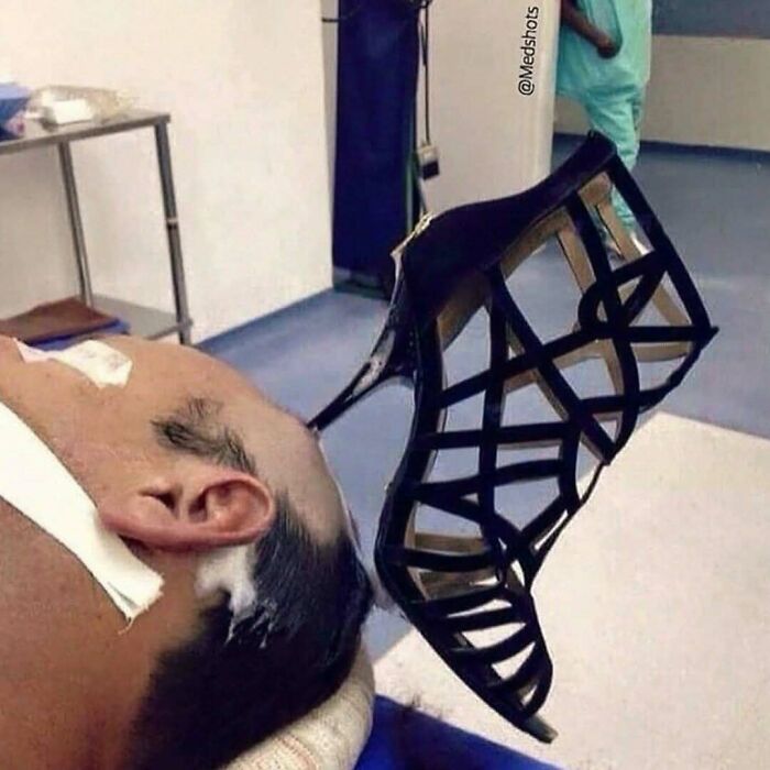 Man lying down with a strappy black high-heeled shoe balanced on his face in a clinical medical setting.