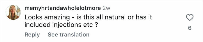 Ulrika Jonsson, 58, revela os seis meses de tratamento por trás de sua transformação dramática Ulrika Jonsson, 58, revela os seis meses de tratamento por trás de sua transformação dramática