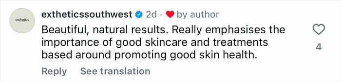 Ulrika Jonsson, 58, revela os seis meses de tratamento por trás de sua transformação dramática Ulrika Jonsson, 58, revela os seis meses de tratamento por trás de sua transformação dramática