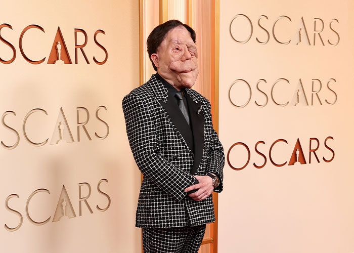Adam Pearson no evento do Oscar, vestido com um terno xadrez, destacando os fãs criticando o tweet ofensivo do comediante sobre ele.