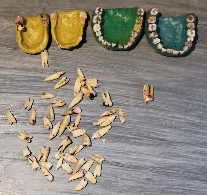 Collection of real human teeth and colored dental molds arranged on a gray wooden surface, Facebook Marketplace unhinged pics.