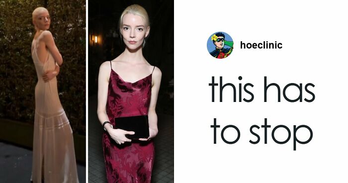 “She Looks Very Unhealthy”: Internet Tore Apart Anya Taylor-Joy’s Pre-Oscars Appearance Amid Ongoing Hollywood Trend