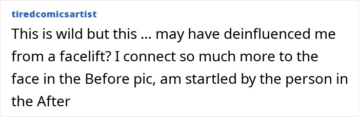 Denise Richards revela transformação dramática do facelift em fotos de antes e depois