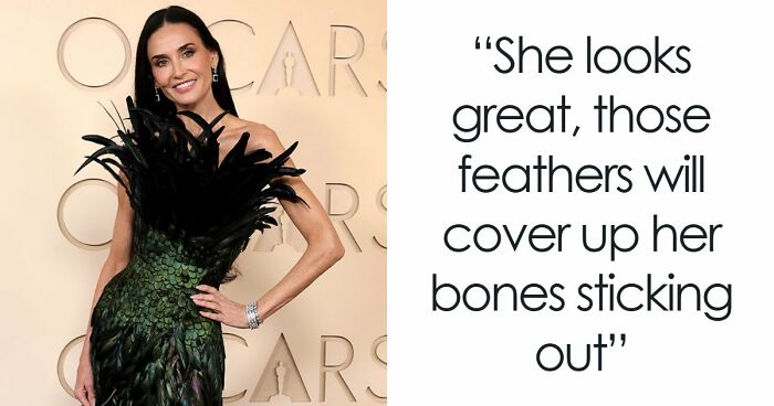 Oscars Red Carpet Stuns Fans As Plastic Surgery And Weight Loss Side Effects On Full Display