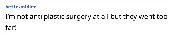 Denise Richards revela transformação dramática do facelift em fotos de antes e depois