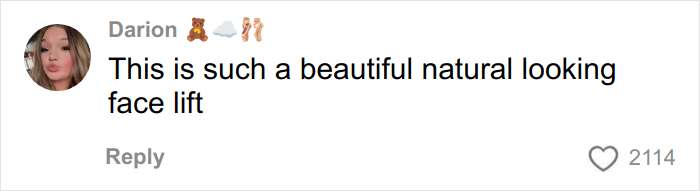Comment praising a beautiful natural looking face lift by a user named Darion with emojis, related to miracle plastic surgeon transformation viral topic.
