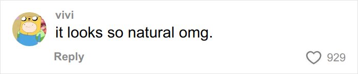 Comment on viral post praising miracle plastic surgeon&rsquo;s natural-looking transformation of grandma to look decades younger.