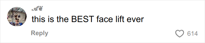 Comment on social media post praising a facelift procedure by a plastic surgeon who went viral for transforming a grandma to look decades younger.