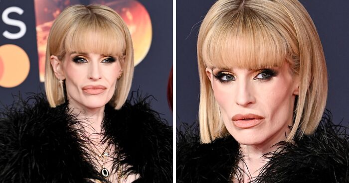 Fans Accuse Kelly Osbourne Of Buccal Fat Removal As Her Brit Awards Look Goes Viral