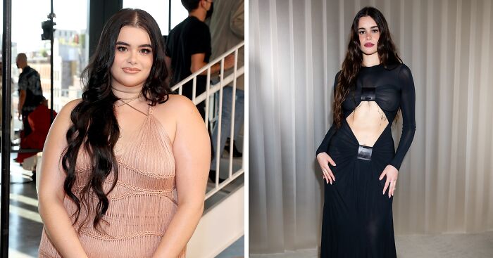 “Longest Neck In The World”: 41 Fascinating But Slightly Disturbing Medical Visuals (New Pics)