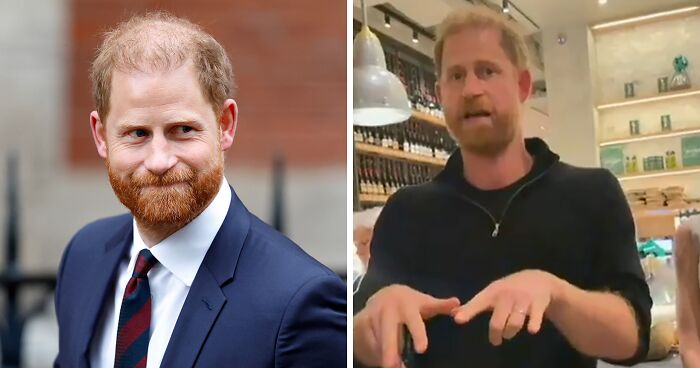 “Longest Neck In The World”: 41 Fascinating But Slightly Disturbing Medical Visuals (New Pics)