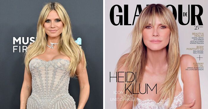 Heidi Klum reveals she suffers from a disorder that she partly credits for her success