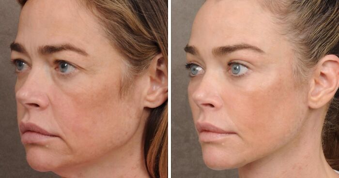 87 Dating Profiles That Are Cringeworthy Enough To Make Your Skin Crawl A Little Bit