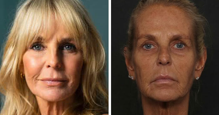 Ulrika Jonsson, 58, Reveals The Six Months Of Treatments Behind Her Dramatic Transformation