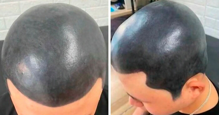 “My Mate Can Do It Cheaper”: 71 Ink Fails That Turned Bad Ideas Into Permanent Regrets