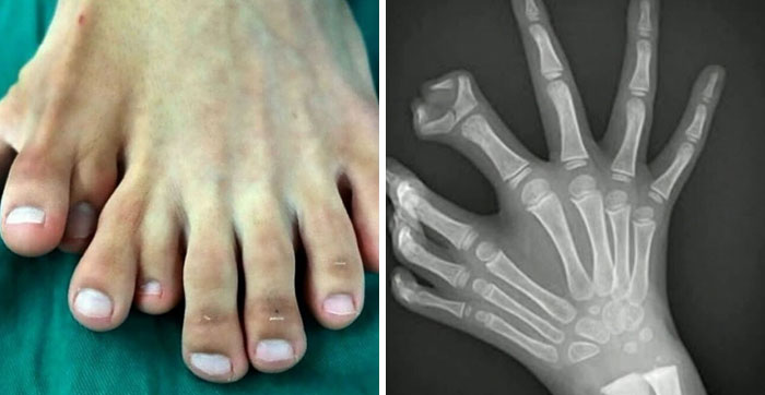 “Green Hairy Tongue!”: These 41 Medical Images Should Be Viewed With Caution (New Pics)