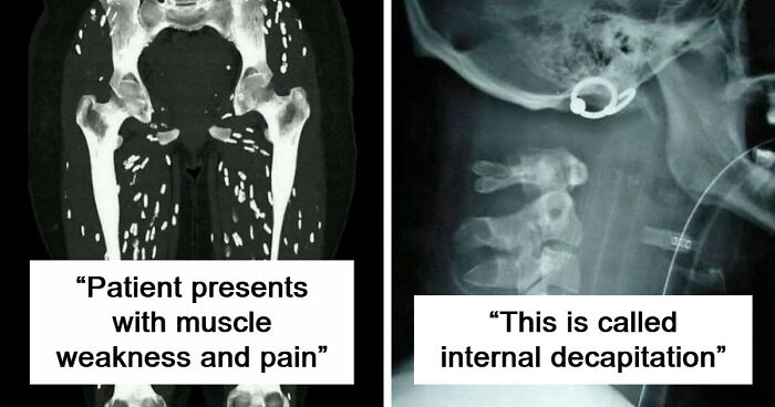 “Green Hairy Tongue!”: These 41 Medical Images That Should Be Viewed With Caution (New Pics)