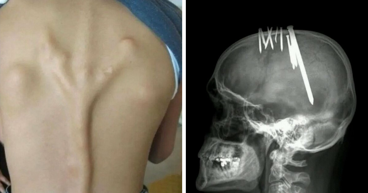 “Green Hairy Tongue!”: These 41 Medical Images That Should Be Viewed With Caution (New Pics) - Bored Panda