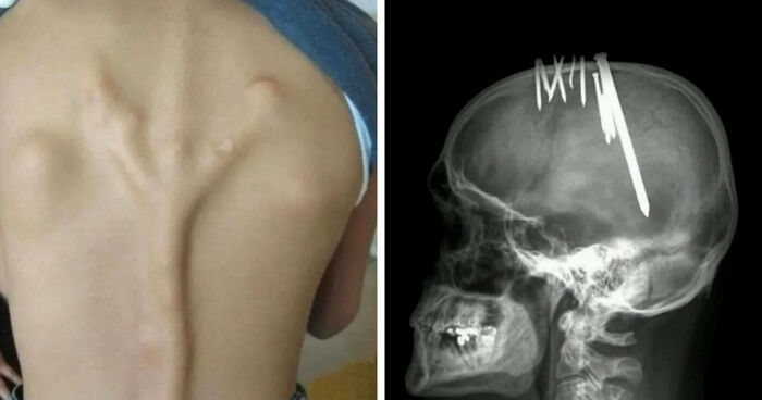 “Green Hairy Tongue!”: These 41 Medical Images That Should Be Viewed With Caution (New Pics)