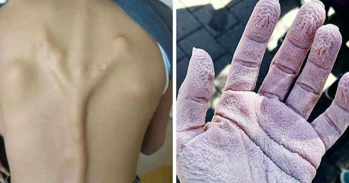 “Green Hairy Tongue!”: These 41 Medical Images That Should Be Viewed With Caution (New Pics)