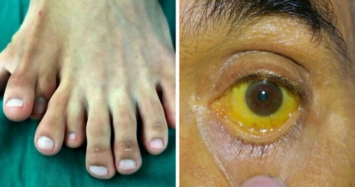 “Green Hairy Tongue!”: These 41 Medical Images That Should Be Viewed With Caution (New Pics)