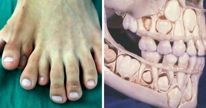 “Green Hairy Tongue!”: These 41 Medical Images That Should Be Viewed With Caution (New Pics)