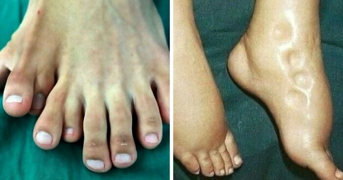 “Green Hairy Tongue!”: These 41 Medical Images That Should Be Viewed With Caution (New Pics)