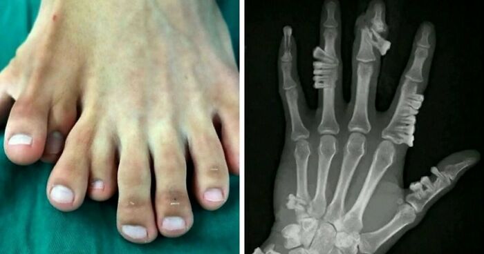 “Green Hairy Tongue!”: These 41 Medical Images That Should Be Viewed With Caution (New Pics)