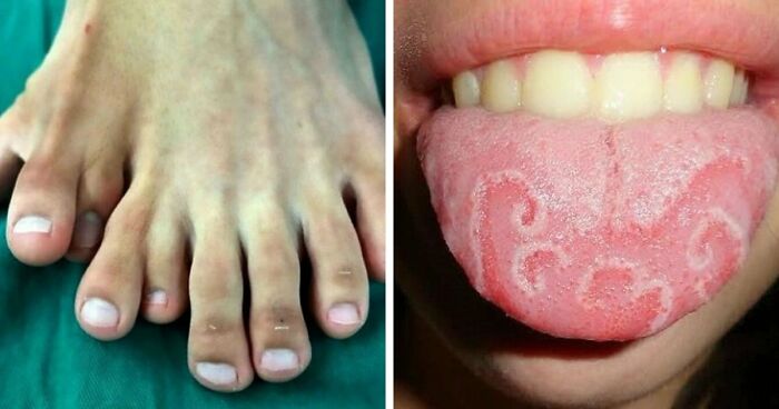 “Green Hairy Tongue!”: These 41 Medical Images That Should Be Viewed With Caution (New Pics)