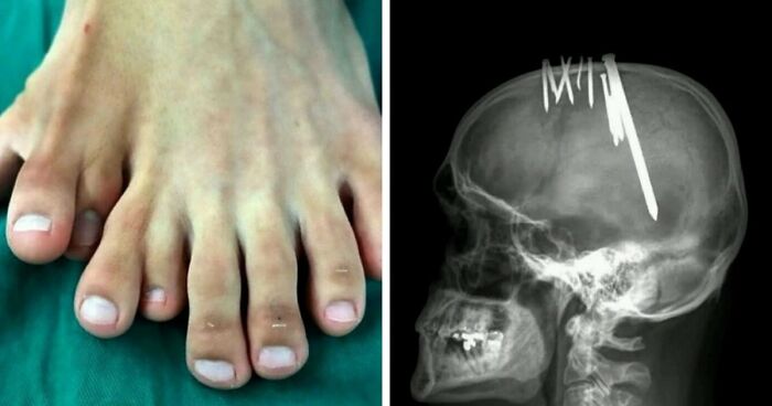 “Green Hairy Tongue!”: These 41 Medical Images That Should Be Viewed With Caution (New Pics)