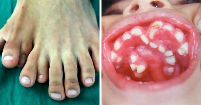 “Green Hairy Tongue!”: These 41 Medical Images That Should Be Viewed With Caution (New Pics)