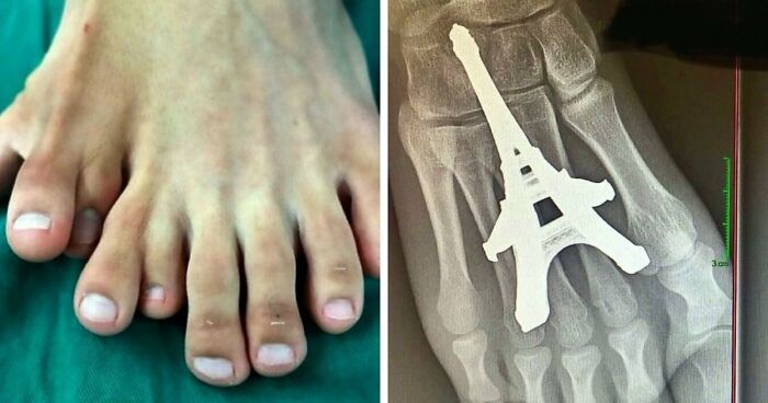 “Green Hairy Tongue!”: These 41 Medical Images That Should Be Viewed With Caution (New Pics)