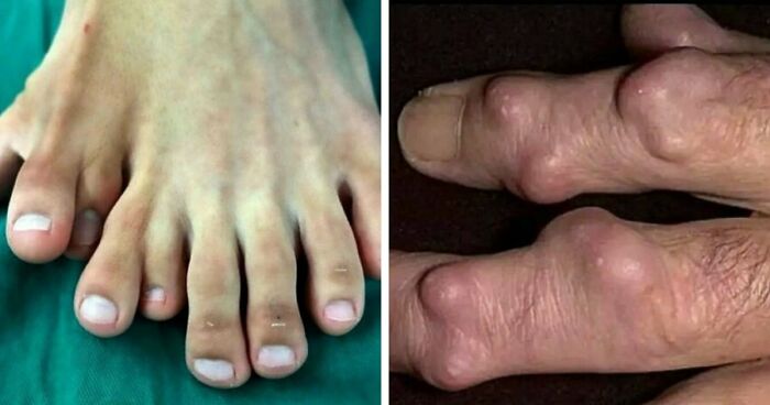 “Green Hairy Tongue!”: These 41 Medical Images That Should Be Viewed With Caution (New Pics)