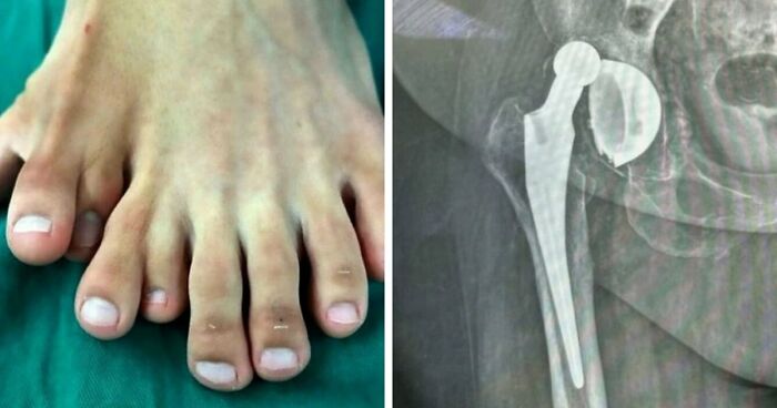 “Green Hairy Tongue!”: These 41 Medical Images That Should Be Viewed With Caution (New Pics)