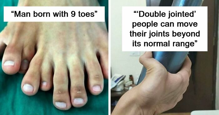 “Green Hairy Tongue!”: These 41 Medical Images That Should Be Viewed With Caution (New Pics)