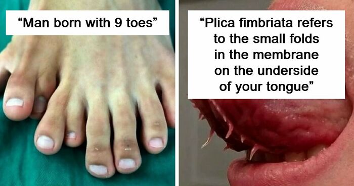 “Green Hairy Tongue!”: These 41 Medical Images That Should Be Viewed With Caution (New Pics)