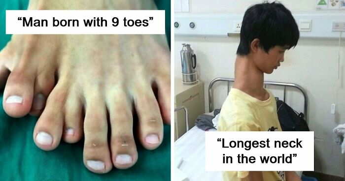 “Green Hairy Tongue!”: These 41 Medical Images That Should Be Viewed With Caution (New Pics)