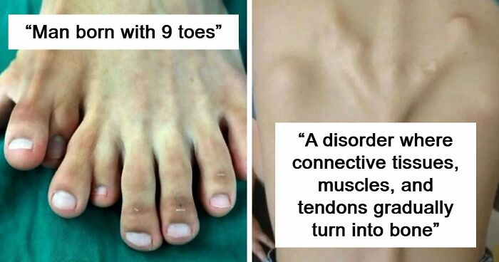 “Green Hairy Tongue!”: These 41 Medical Images That Should Be Viewed With Caution (New Pics)