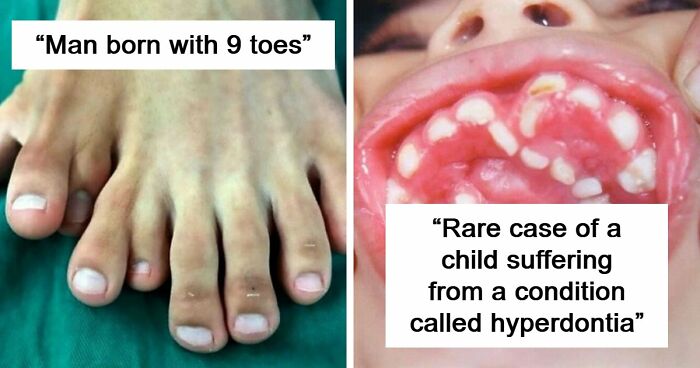 “Green Hairy Tongue!”: These 41 Medical Images Should Be Viewed With Caution (New Pics)