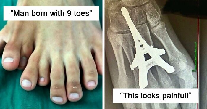 “Green Hairy Tongue!”: These 41 Medical Images That Should Be Viewed With Caution (New Pics)